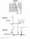 Fig. 10 - Road line recognition apparatus