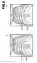 Fig. 09 - Computer-aided image diagnosis