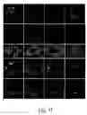 Fig. 11 - System and method for using learned discriminative models to segment three dimensional colon image data