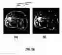 Fig. 06 - System and method for reducing artifacts in motion corrected dynamic image sequences