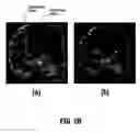 Fig. 07 - System and method for reducing artifacts in motion corrected dynamic image sequences