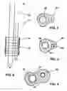 Fig. 03 - Illuminated writing instrument