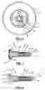 Fig. 05 - Corrosion-resistant metal fasteners and stud inserts