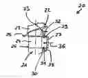 Fig. 01 - Apparatus and method for anchoring a rotor blade in a rotor of a turbo machine