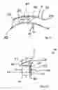 Fig. 04 - Apparatus and method for anchoring a rotor blade in a rotor of a turbo machine