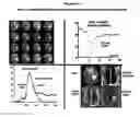 Fig. 06 - Imaging methods for early detection of brain tumors following embryonic stem cell implants