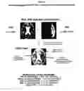 Fig. 09 - Imaging methods for early detection of brain tumors following embryonic stem cell implants