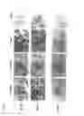 Fig. 07 - Oncolytic virus replicating selectively in tumor cells
