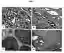 Fig. 03 - Compositions and methods of use of targeting peptides for diagnosis and therapy of human cancer