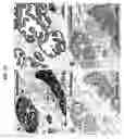 Fig. 11 - Compositions and methods of use of targeting peptides for diagnosis and therapy of human cancer
