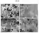 Fig. 13 - Compositions and methods of use of targeting peptides for diagnosis and therapy of human cancer