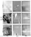 Fig. 16 - Compositions and methods of use of targeting peptides for diagnosis and therapy of human cancer