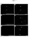 Fig. 26 - Compositions and methods of use of targeting peptides for diagnosis and therapy of human cancer