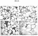 Fig. 29 - Compositions and methods of use of targeting peptides for diagnosis and therapy of human cancer