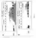 Fig. 07 - Adiponectin gene therapy