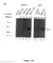 Fig. 03 - Methods for treating cancers and restenosis with p21