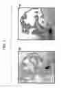 Fig. 08 - Methods of isolating dopaminergic neuron precursor cells