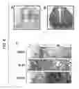Fig. 09 - Methods of isolating dopaminergic neuron precursor cells