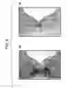Fig. 10 - Methods of isolating dopaminergic neuron precursor cells