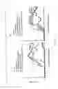 Fig. 02 - Dendritic cell presenting a-glycosylceramide derivative and antigent and usable in suppressing immune response