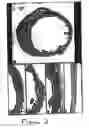 Fig. 03 - Methods and compositions for the repair and/or regeneration of damaged myocardium