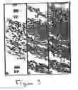 Fig. 04 - Methods and compositions for the repair and/or regeneration of damaged myocardium