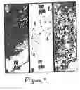 Fig. 10 - Methods and compositions for the repair and/or regeneration of damaged myocardium