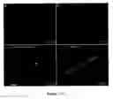 Fig. 101 - Methods and compositions for the repair and/or regeneration of damaged myocardium
