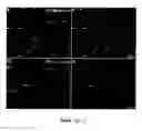 Fig. 111 - Methods and compositions for the repair and/or regeneration of damaged myocardium