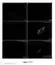 Fig. 113 - Methods and compositions for the repair and/or regeneration of damaged myocardium