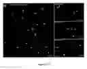 Fig. 115 - Methods and compositions for the repair and/or regeneration of damaged myocardium