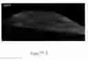 Fig. 134 - Methods and compositions for the repair and/or regeneration of damaged myocardium