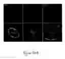 Fig. 136 - Methods and compositions for the repair and/or regeneration of damaged myocardium