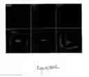 Fig. 137 - Methods and compositions for the repair and/or regeneration of damaged myocardium