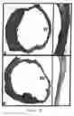 Fig. 14 - Methods and compositions for the repair and/or regeneration of damaged myocardium
