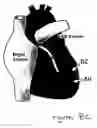 Fig. 146 - Methods and compositions for the repair and/or regeneration of damaged myocardium