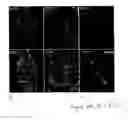Fig. 149 - Methods and compositions for the repair and/or regeneration of damaged myocardium