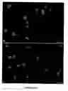 Fig. 34 - Methods and compositions for the repair and/or regeneration of damaged myocardium