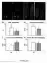 Fig. 45 - Methods and compositions for the repair and/or regeneration of damaged myocardium