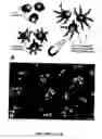 Fig. 65 - Methods and compositions for the repair and/or regeneration of damaged myocardium