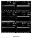 Fig. 87 - Methods and compositions for the repair and/or regeneration of damaged myocardium