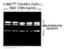 Fig. 92 - Methods and compositions for the repair and/or regeneration of damaged myocardium