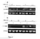 Fig. 05 - Promoter to IL-18BP, its preparation and use
