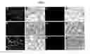 Fig. 02 - Method of preparing cell for transplantation