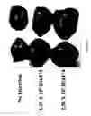 Fig. 05 - Methods of inhibiting angiogenesis-dependent conditions mediated by cryptic epitopes of extracellular matrix components