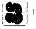 Fig. 09 - Methods of inhibiting angiogenesis-dependent conditions mediated by cryptic epitopes of extracellular matrix components