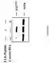 Fig. 23 - Methods of inhibiting angiogenesis-dependent conditions mediated by cryptic epitopes of extracellular matrix components