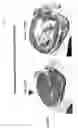 Fig. 03 - Methods for treating tweak-related conditions