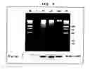 Fig. 08 - Apoptosis-associated protein and use thereof