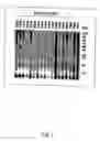 Fig. 02 - Chlamydia pneumoniae antigens